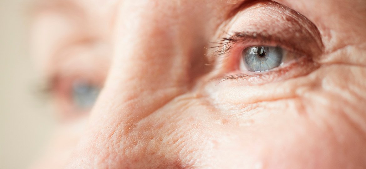 Tremor nas pálpebras: Saiba o que pode significar!