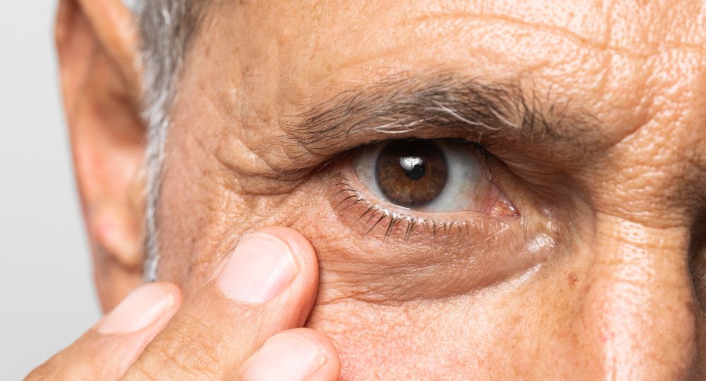 doenças oculares comuns no inverno
